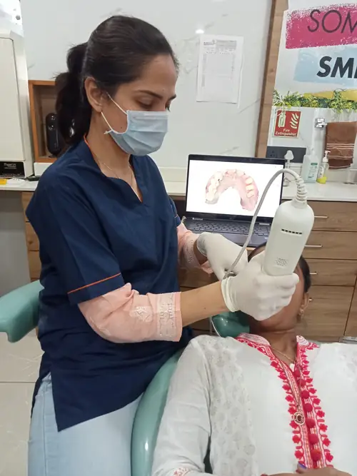 Intraoral Scanning
