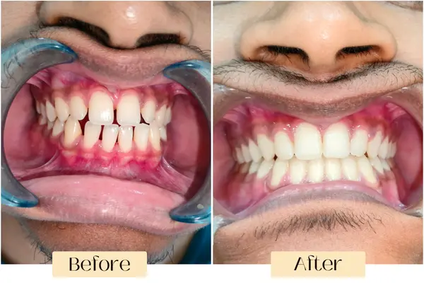 before after image 1