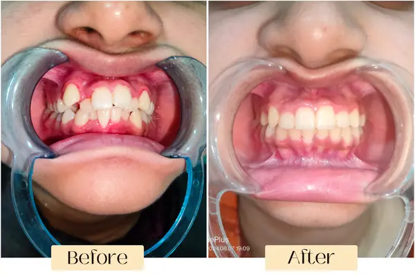 before after image 2