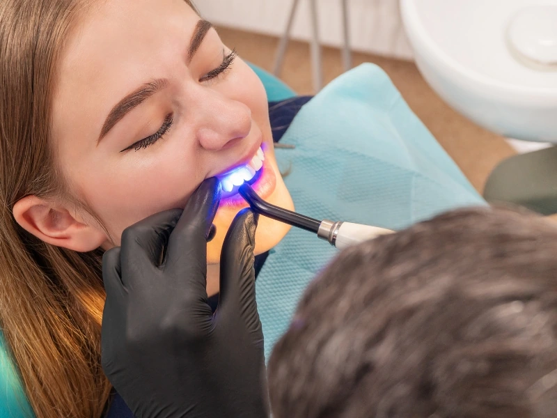 Laser Dentistry